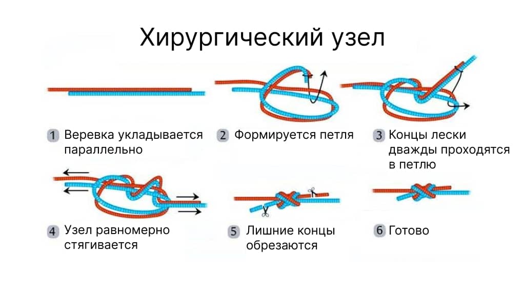 Хирургическая петля: быстрее не бывает